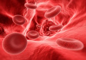 vasculita